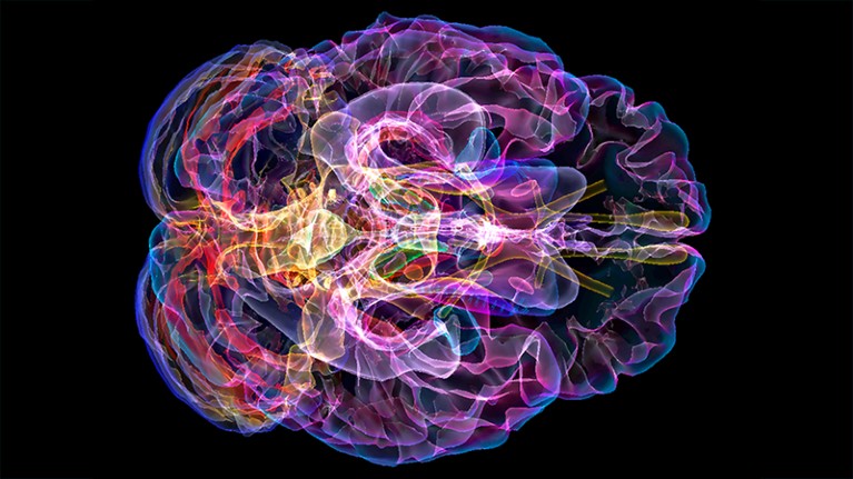 Stop the Silence: Speak Up About Alzheimer's